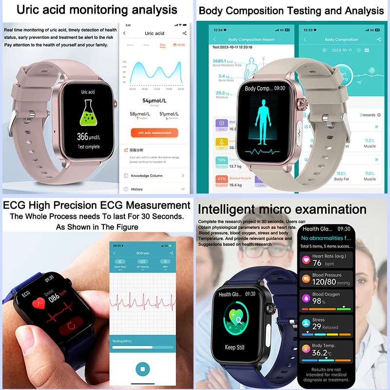 2025 New ECG+PPG Monitoring Sm - Smartwatch Watches For Girls ulasan dan harga